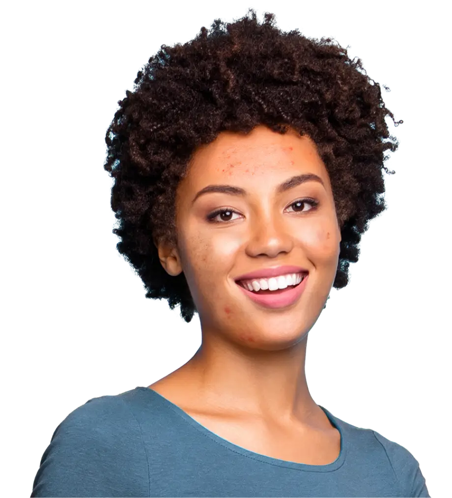 Actor portrayal of an acne patient who could be treated with CABTREO. Not an actual patient.