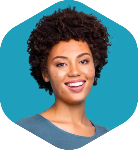 Actor portrayal of an acne patient who could be treated with CABTREO. Not an actual patient.